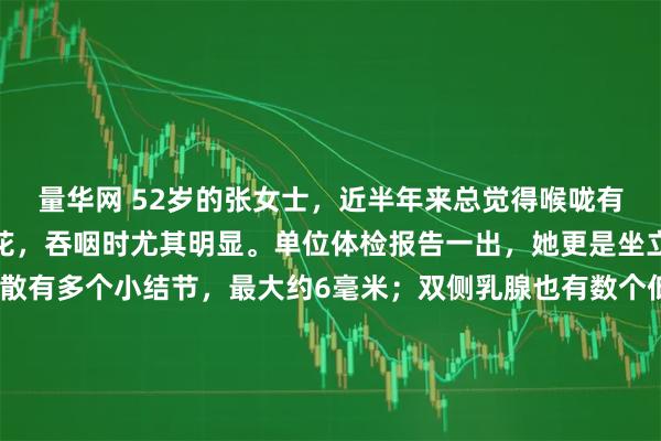 量华网 52岁的张女士，近半年来总觉得喉咙有异物感，像堵着一团棉花，吞咽时尤其明显。单位体检报告一出，她更是坐立不安：报告提示双肺散有多个小结节，最大约6毫米；双侧乳腺也有数个低回声结节，评级3类。她反复翻看报告，整日无精打采，她最怕两件事：一是这些“小东西”悄无声息地长大、恶变；二是听人说结节会